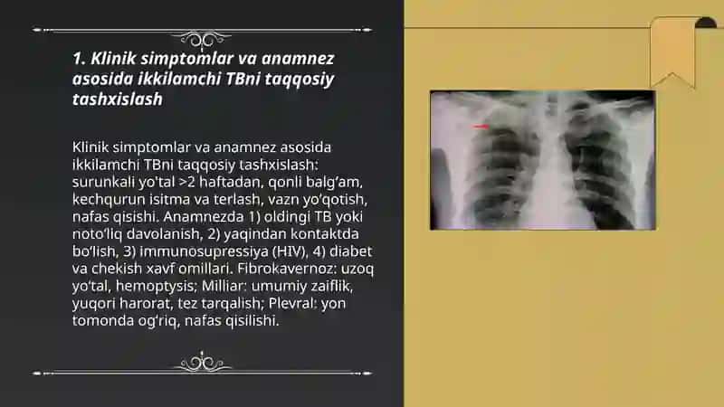 Ikkilamchi Tuberkulyoz klinik shakllarni qiyosiy tashhislashning asosiy usullari 3