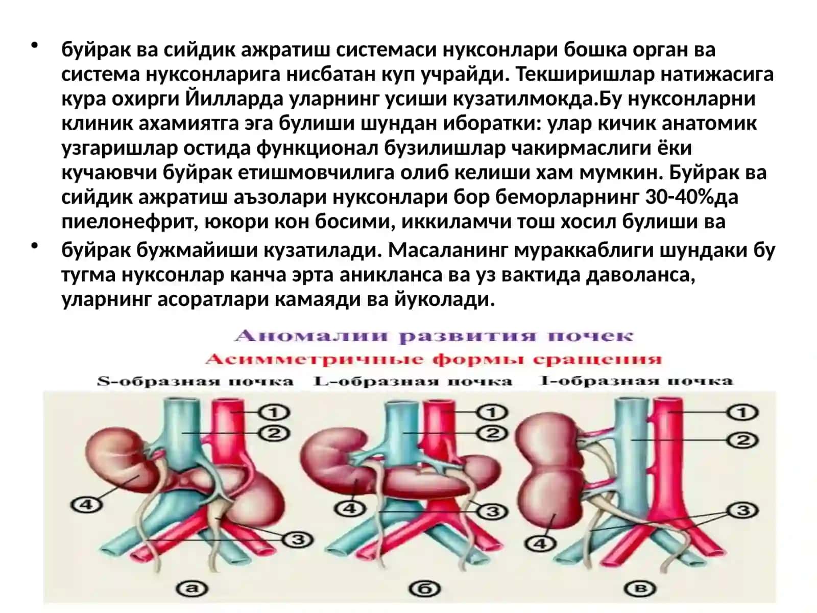 Буйрак, сийдик йуллари ривожланиш нуксонлари ва сийдик тош касаллиги диагностикаси ва даволаш тактикаси 3