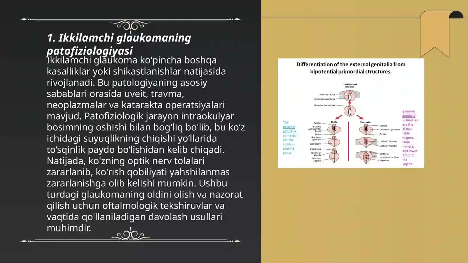 Ikkilamchi va asoratli glaukomani tashxisi va davolash usullari 3