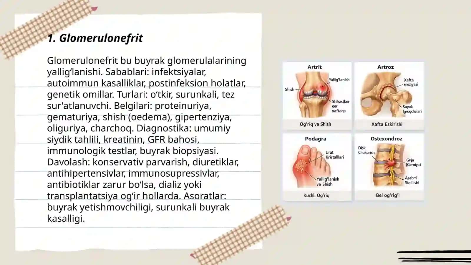 Glomerulonefrit 3