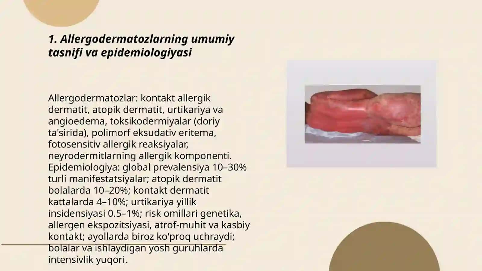 Allergodermatozlar 3