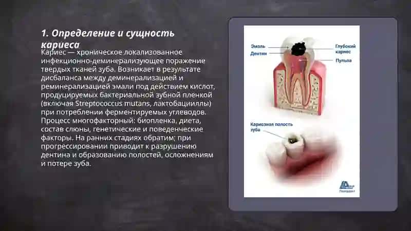КАРИЕС 3