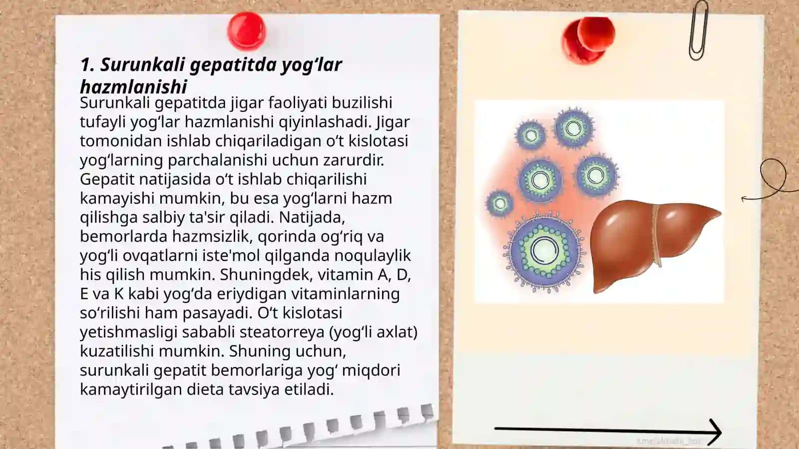 Surunkali gepatitlar va xolesistitlarda yogʻlar hazmlanishini buzilishi 3