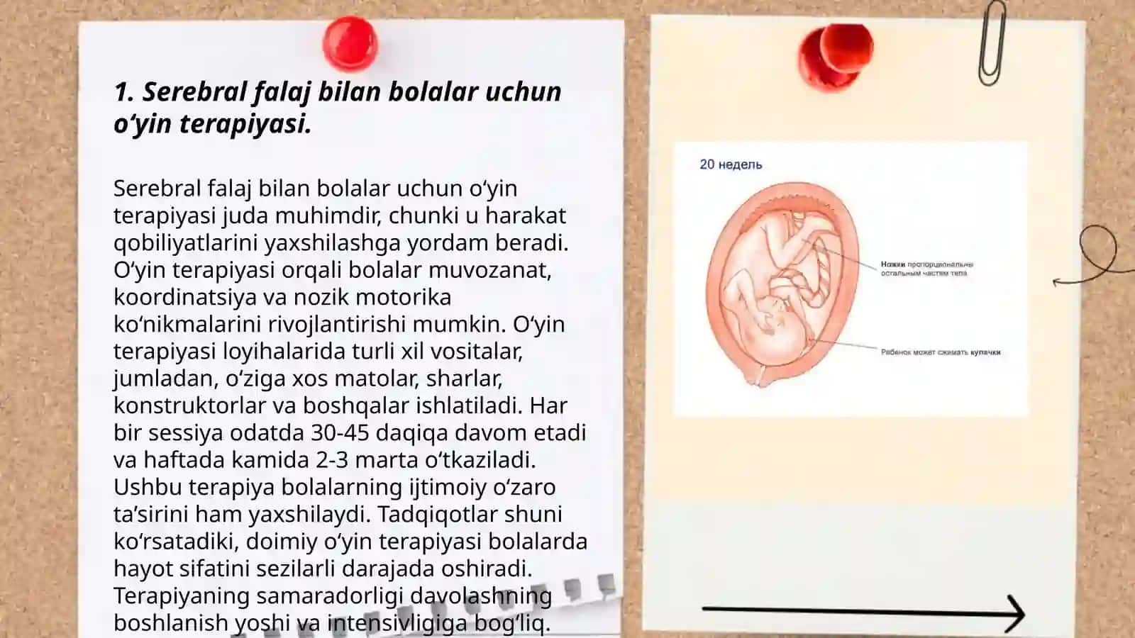 Serebral falaj, turizm,daun kasalligi bo‘lgan bolalar bilan olib boriladigan korreksion pedagogik ishlar 3