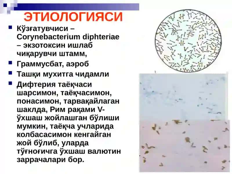 БЎҒМА – ДИФТЕРИЯ 3