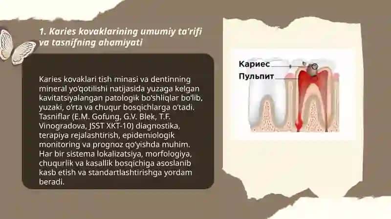 Karies tushunchasi 3
