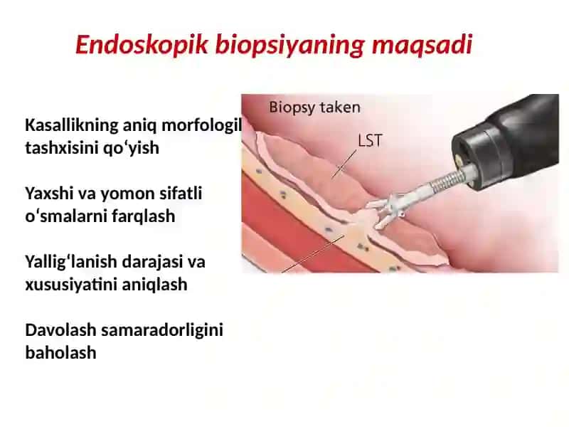 Endoskopik biopsiya 3