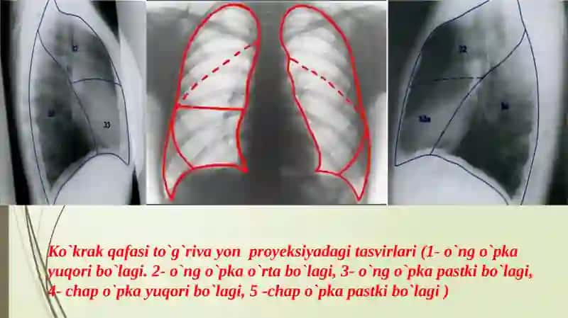 Nafastizimirentgenologik tekshiruvi 3
