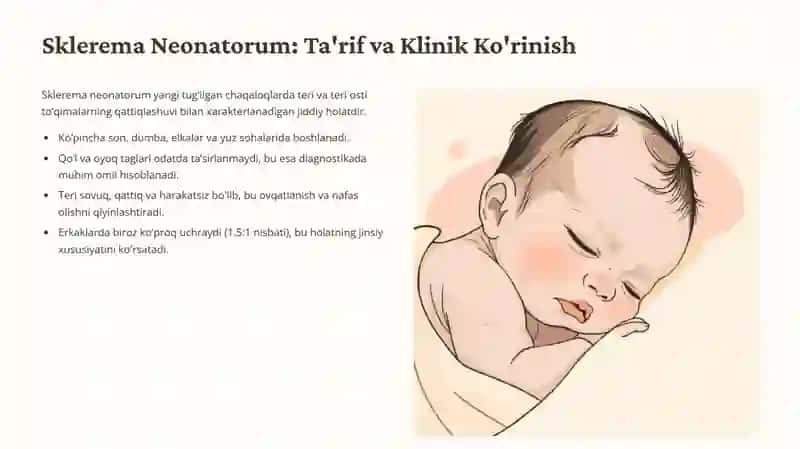 Teri osti yog‘ qatlamini hususiyatlari. Umumiy va cheklangan teri shishi: yangi tug‘ilgan chaqaloqlarda sklerema va skleredema. 3
