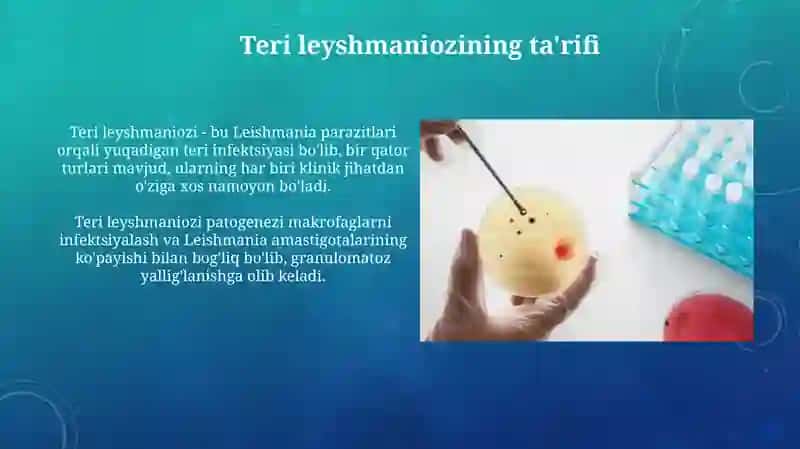 Teri Leyshmaniozlar patogenezi klinikasi epidemiologiyasi davolashi profilaktikasi 3