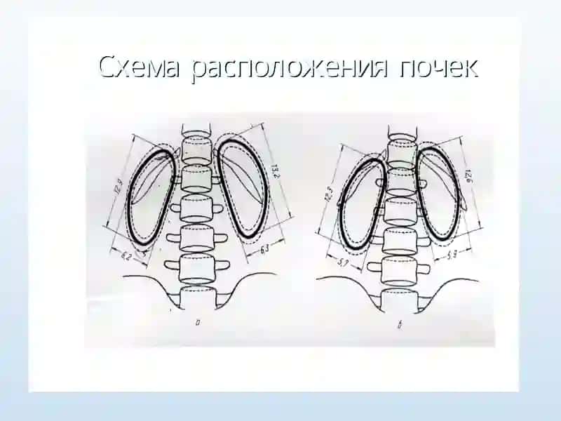 Термиз Иқтисодиёт ва СервисУниверситети Тиббий клиник фанлар кафедраси«Тиббий радиология» фани 3