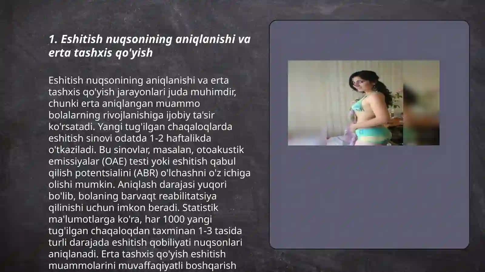 Koxlear implantli bolalar 3