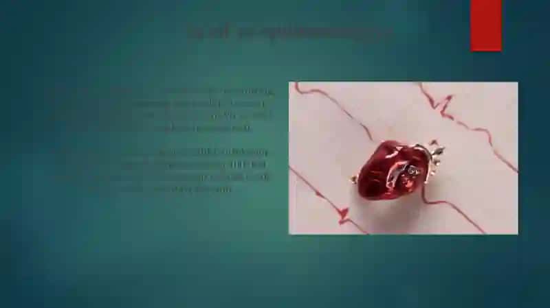 Infektsion endokardit 3