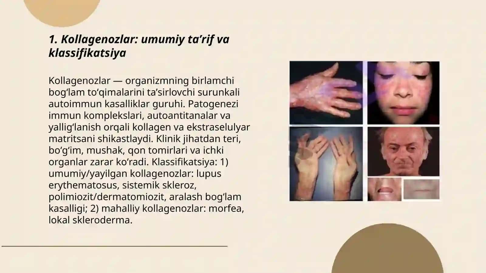 Kollagenozlar. Disxromiyalar. Sklerodermiya. Qizil yugurik 3