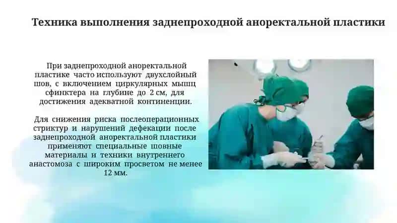 Операции при болезнях мегаколон и гиршпрунг 3