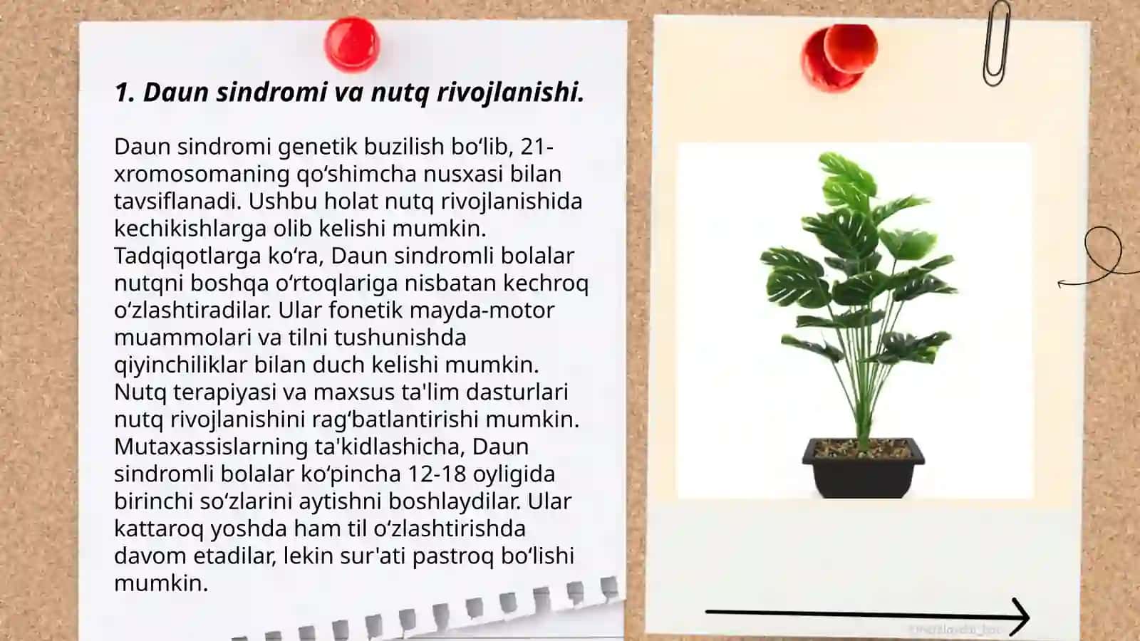 Daun sindromli bolalarning nutq hususiyatlari 3