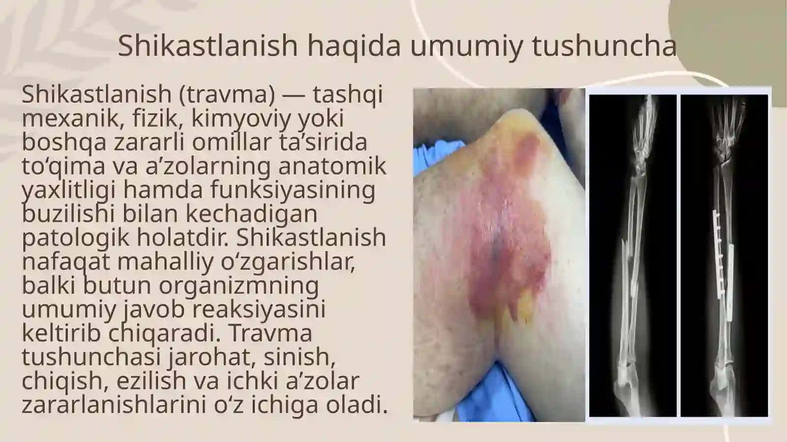 Shikastlanish asoslari: tushuncha va klassifikatsiyasi 3