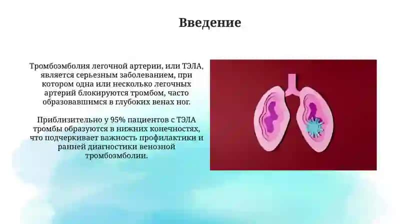 Тромбоэмболия легочной артерии 3