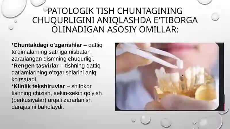 Patologik tish cho‘ntagining chuqurligini aniqlash. Patologik tish qimirlashi va uning darjalari. Perkussiya turlari. 3