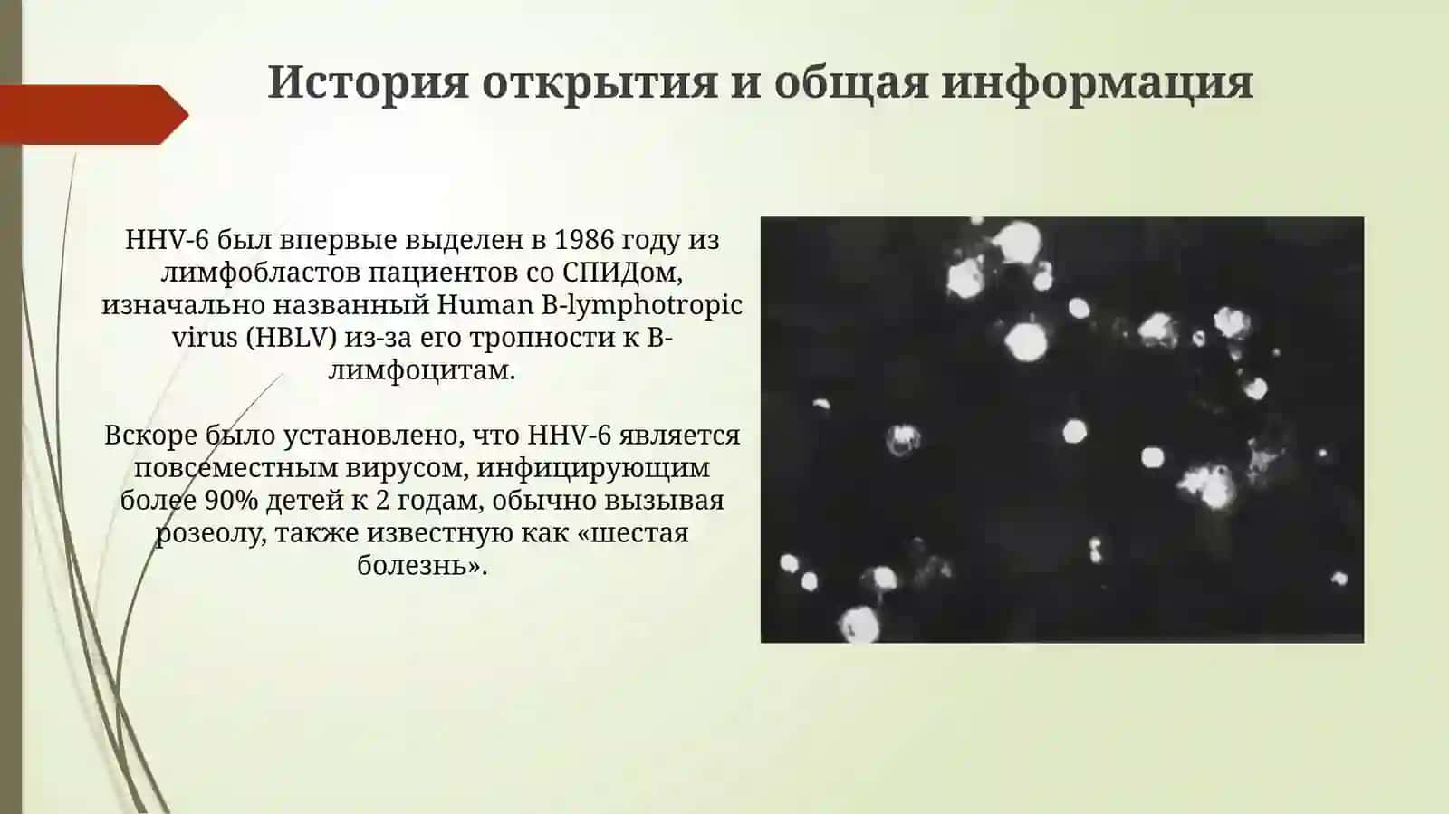HHV-6 Инфекция 3