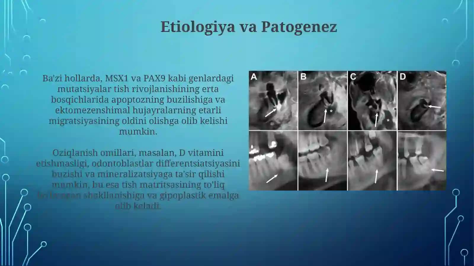 Tugallanmagan odontogenez 3