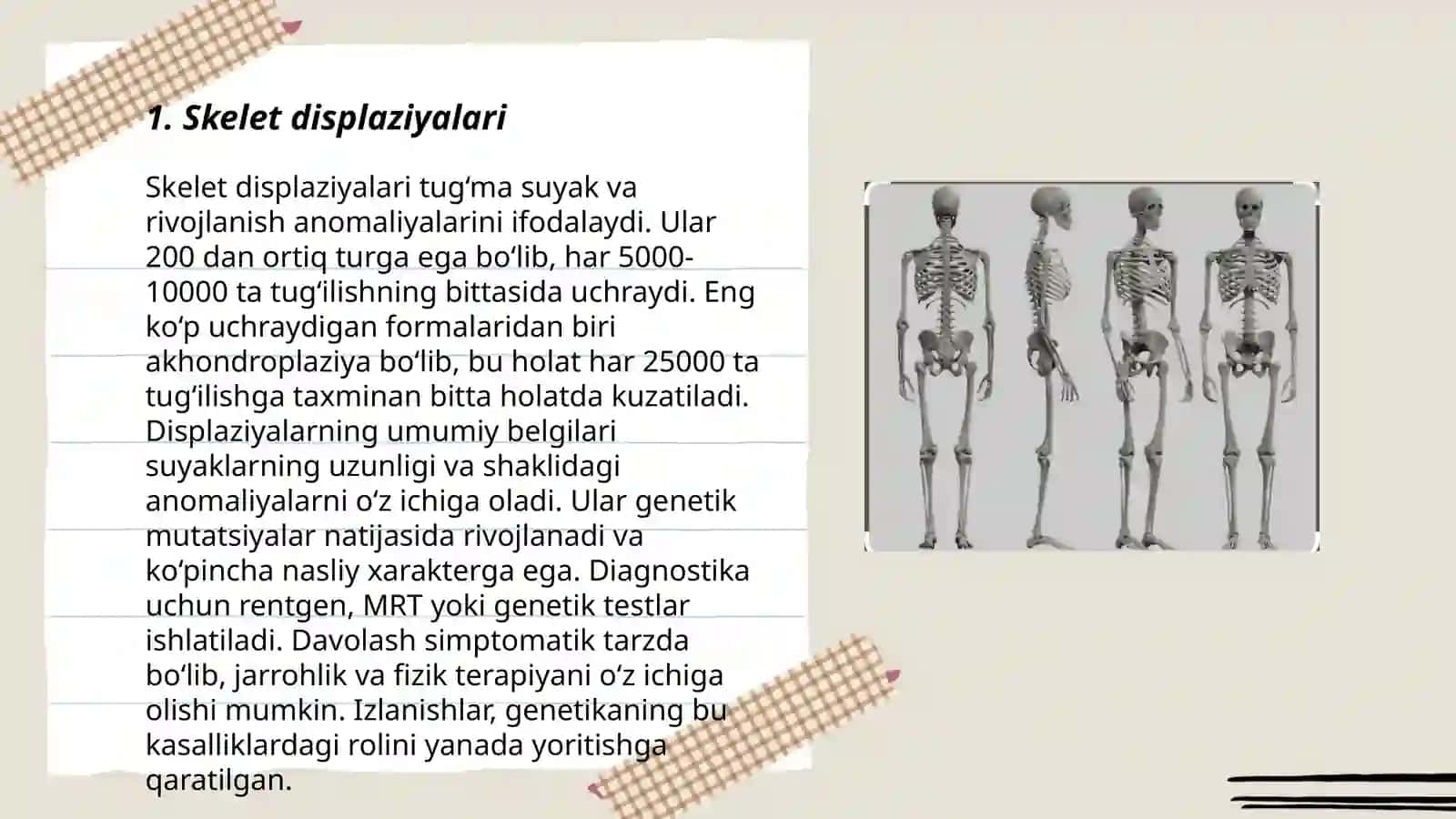 Skletning rivojlanish anamalyalari 3