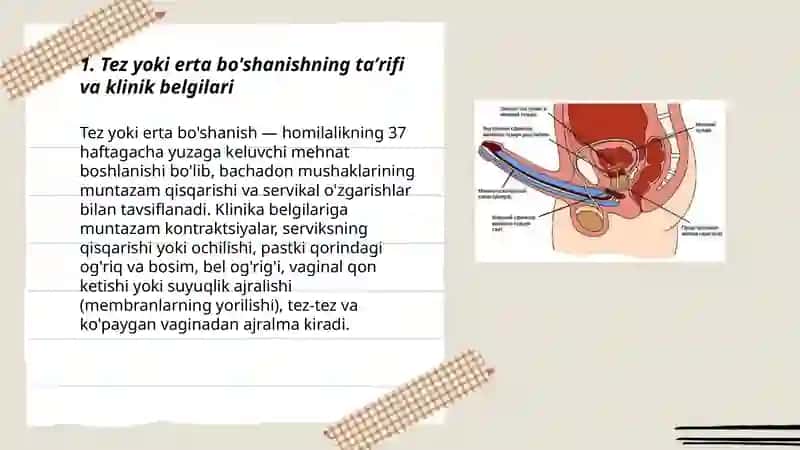 Tez yoki erta bo'shanish 3