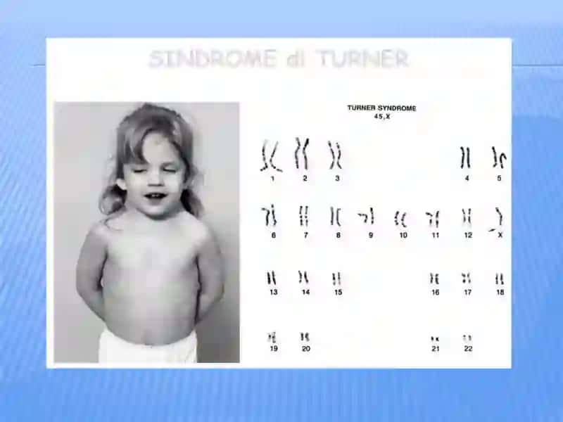 Shereshevskiy-Turner 3