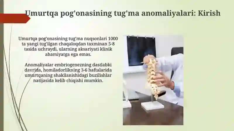Umurtqa pog'onasining tug'ma anomaliyalari 3