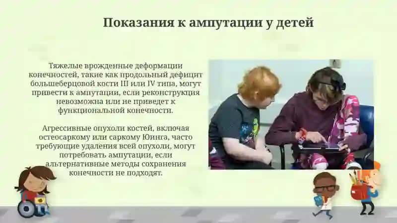 Особенности ампутации у детей 3