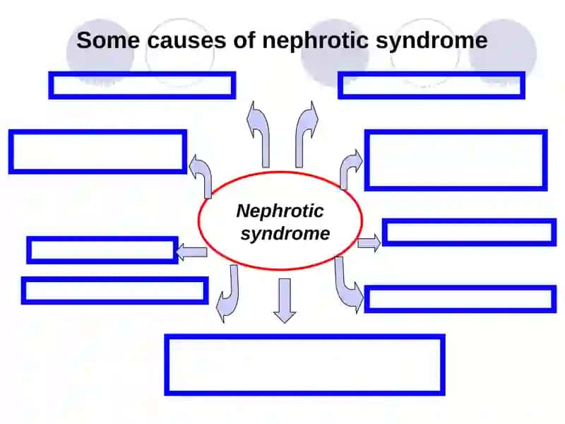 Differential diagnosis of nephrotic syndromeTactics of GP 3
