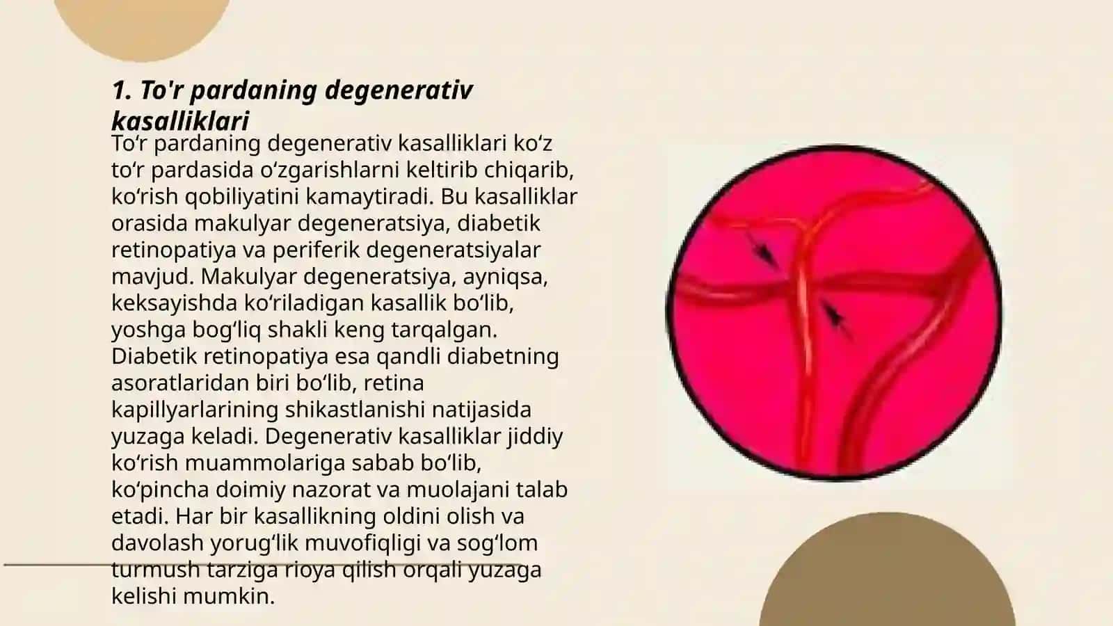 To'r parda va ko'ruv nervining kasalliklari 3