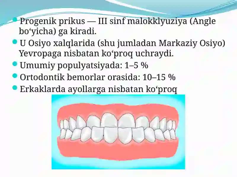 Progenik prikus 3