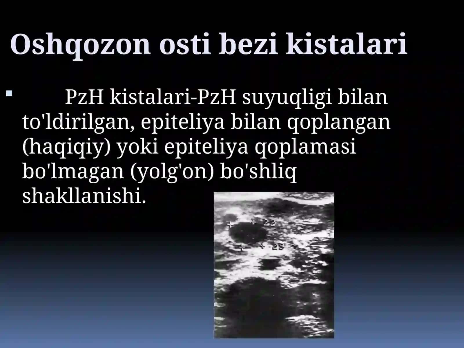Oshqozon osti bezi kistalari 3