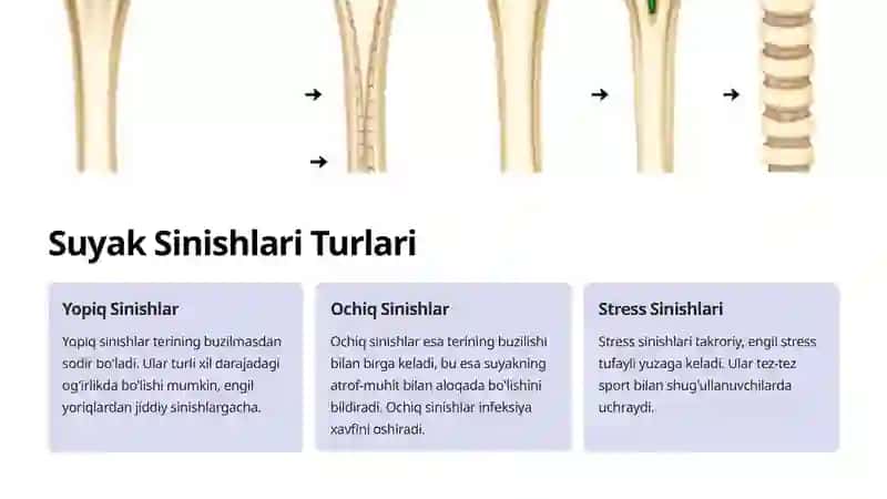 Suyak sinishlari 3