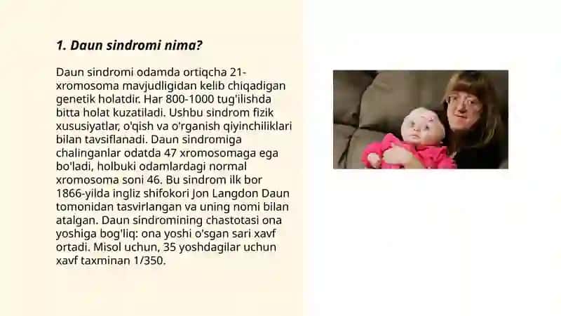 Daun sindromi 3