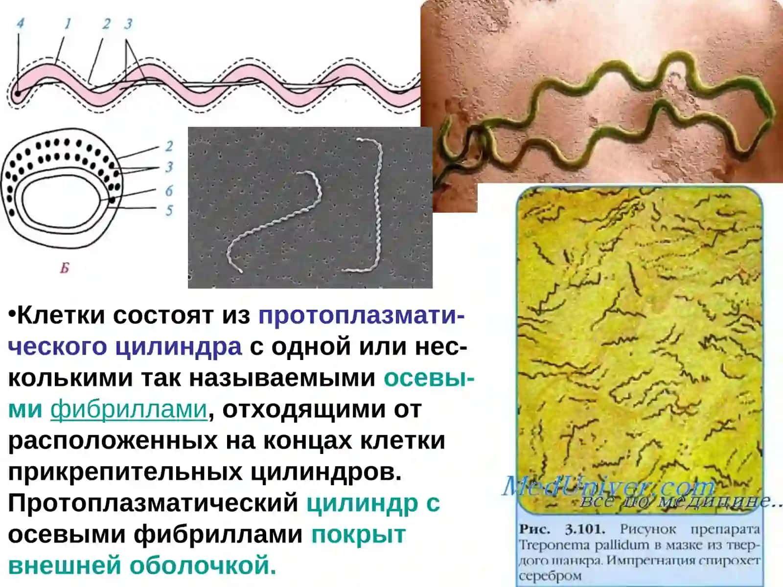 Спирохетозы 3