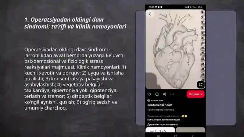 Operatsiyadan oldingi davr sindromi 3