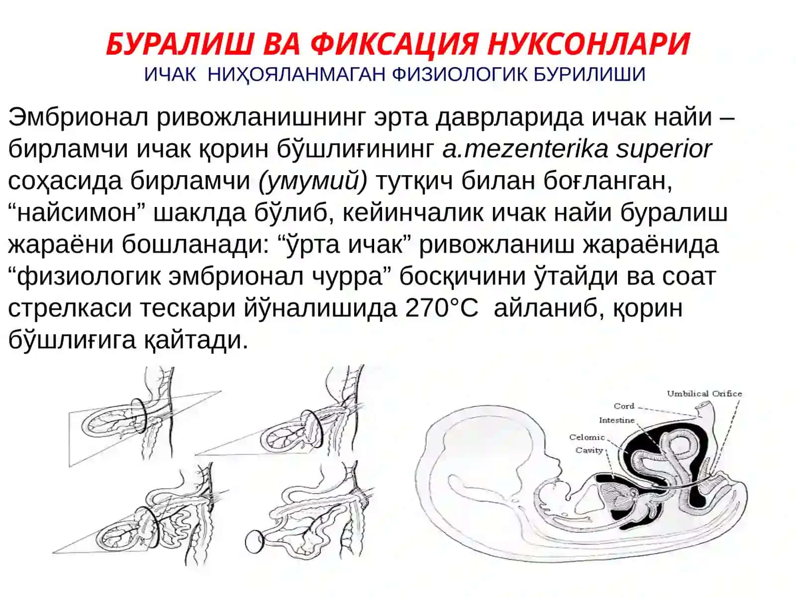 Қорин олд девори, Қорин-парда қин ўсимтасининг ривожланиш нуқсонлари ва аномалиялари 3