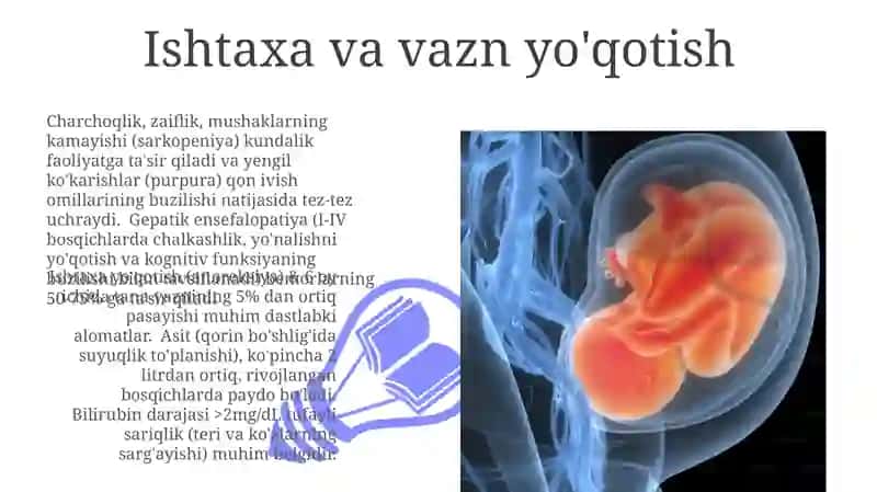 Jigar sirrozlari simptomatologiyasi 3