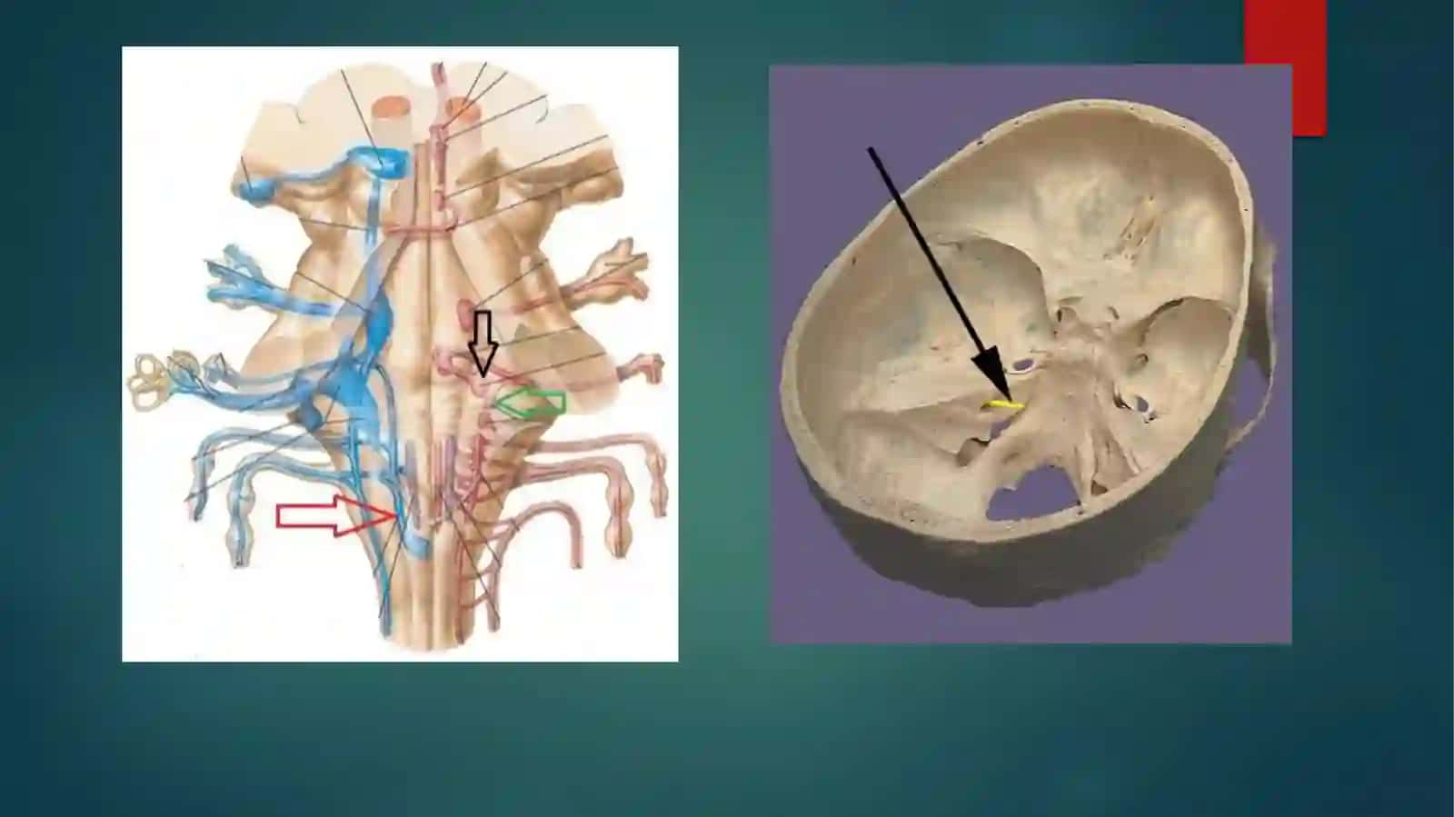 VIIjuftnervi.Anatomiyasi,topografiyasivayo`li,tekshirishusullari,topikdiagnostikasi,zararlanishsimptomlari 3