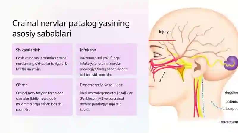 Crainal Nervlarning Patalogiyasi 3