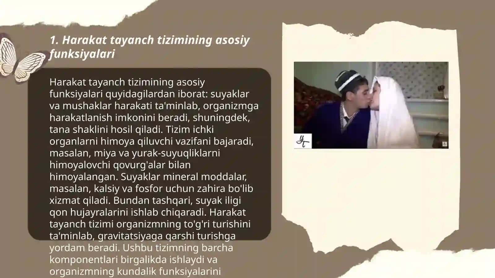 Harakat tayanch aʼzolari jarohatlangan bolalar 3