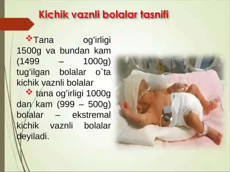 Muddatiga etmay tug’ilgan chaqaloq 3