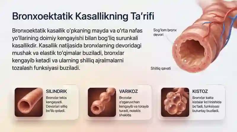 Bronxoekatik Kasallik diagnostikasi 3