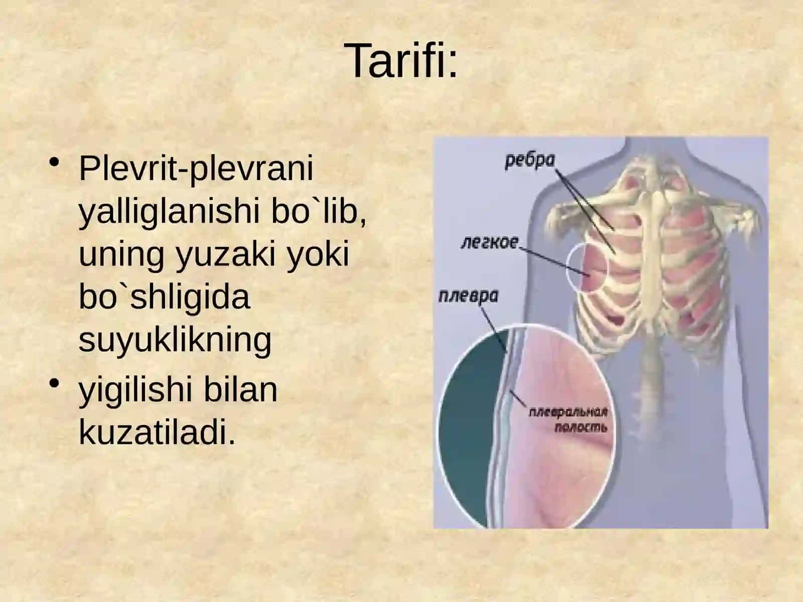 Bolalarda plevritlar. Etiologiyasi, klinikasi ,davolash 3