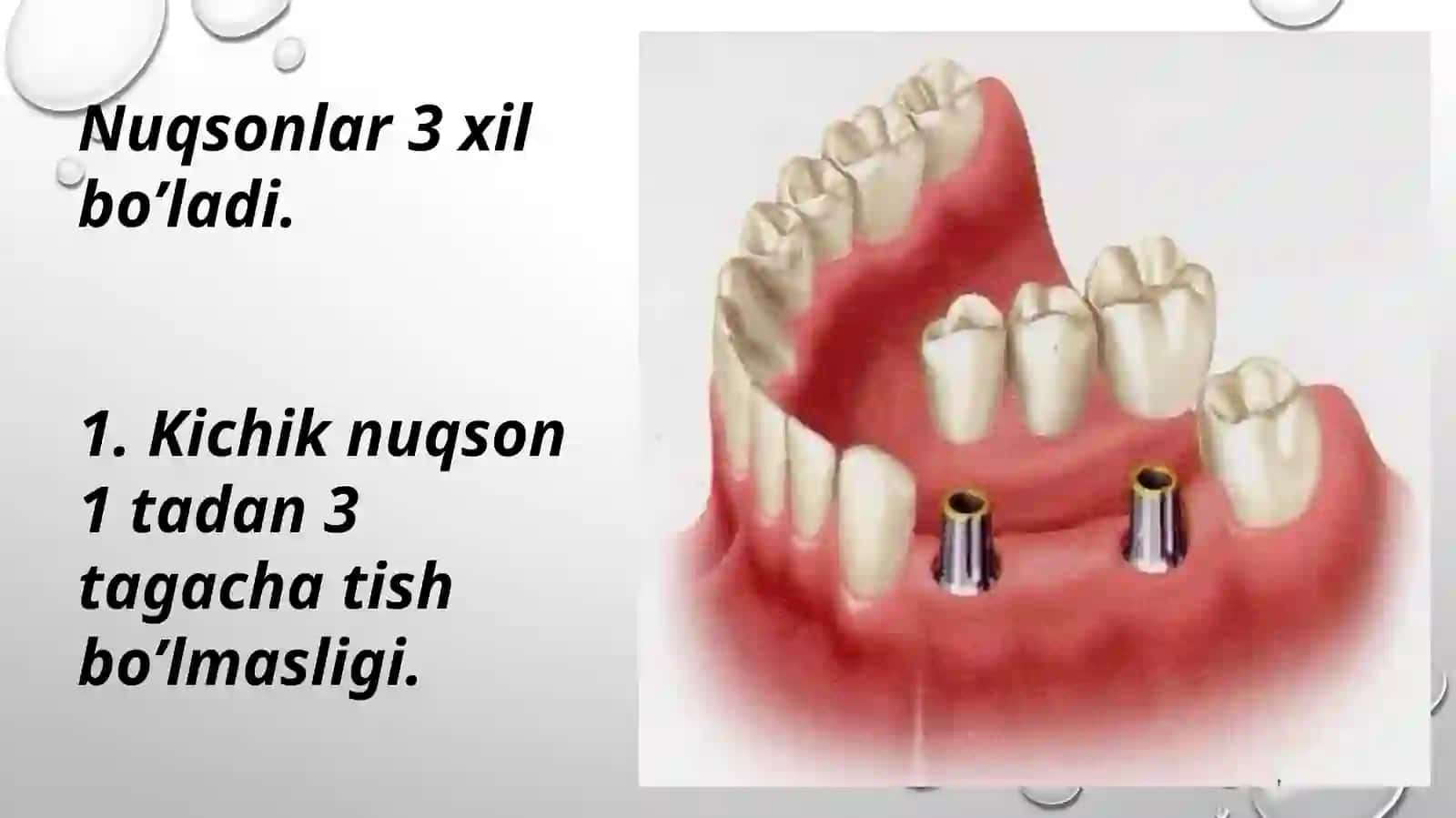 Tish qatorlari qisman nuqsonlari tasnifi. 3