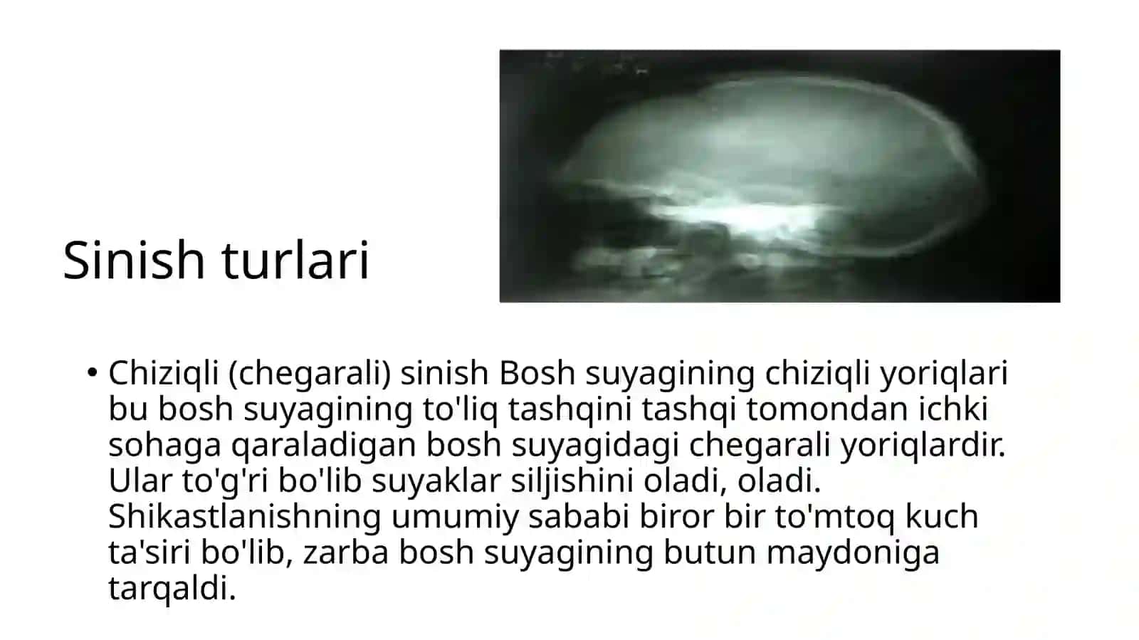 Kalla suyaklarining rentgenanatomiyasi 3