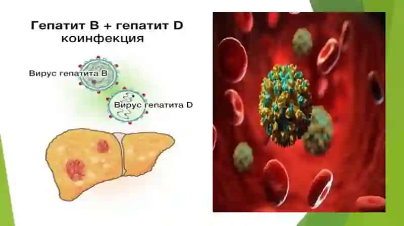 Virusli gepatit D Epidemiyologiya va Davolash 3