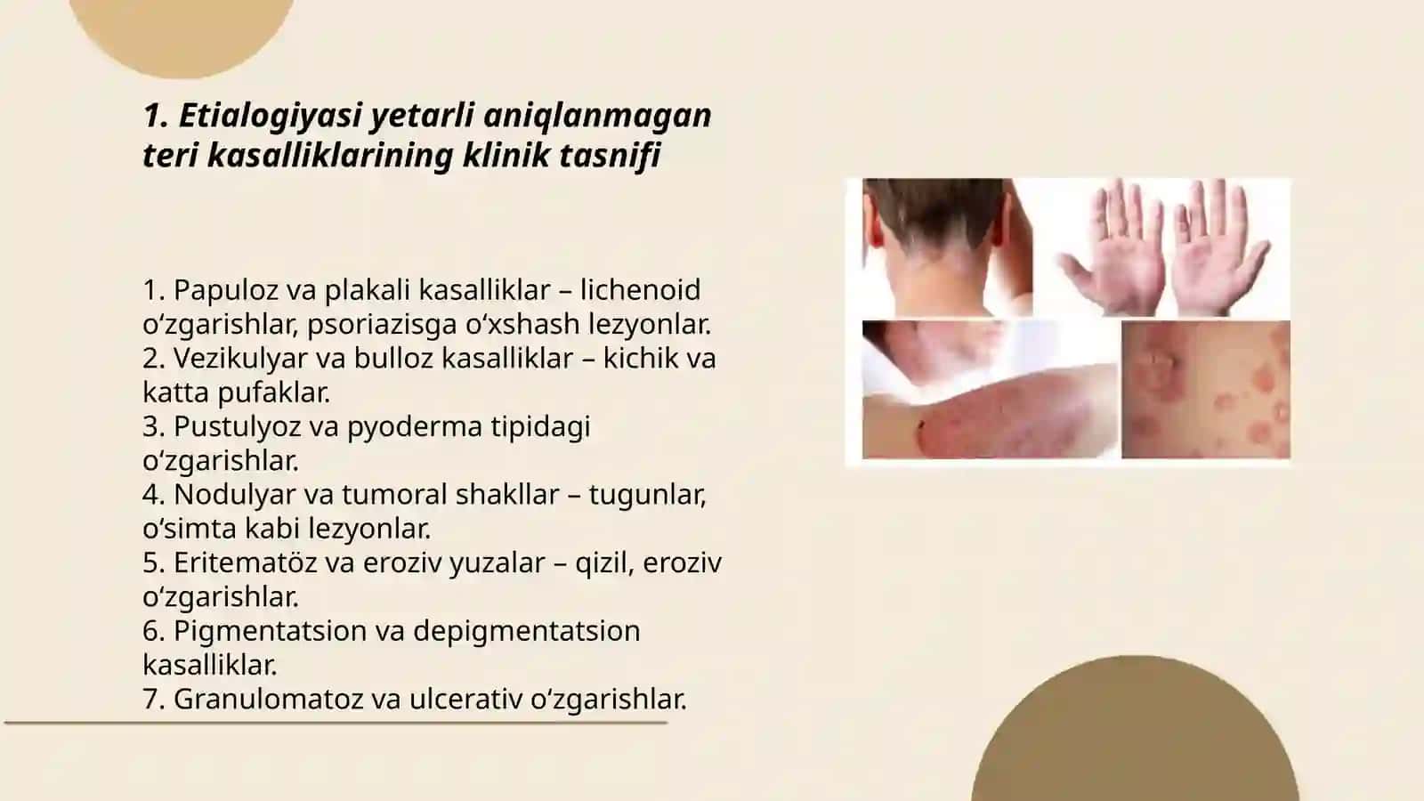 Etialogiyasi yetarli aniqlanmagan teri kasaliklari 3